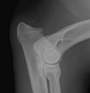 Radiografía de un codo normal en un perro menor de un año
